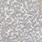 ABCA3 Antibody in Immunohistochemistry (IHC)