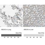 ABCA3 Antibody