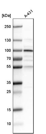 LEPREL1 Antibody in Western Blot (WB)