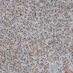 SLC39A9 Antibody in Immunohistochemistry (IHC)