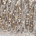 UBE2Z Antibody in Immunohistochemistry (Paraffin) (IHC (P))