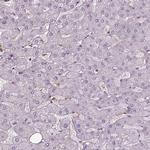 ISYNA1 Antibody in Immunohistochemistry (IHC)