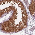 ISYNA1 Antibody in Immunohistochemistry (IHC)