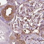 ISYNA1 Antibody in Immunohistochemistry (IHC)