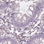 ISYNA1 Antibody in Immunohistochemistry (IHC)