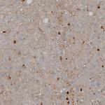 VISTA Antibody in Immunohistochemistry (IHC)