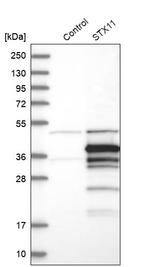 STX11 Antibody in Western Blot (WB)