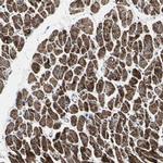 UQCRC2 Antibody in Immunohistochemistry (IHC)