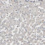 GPD2 Antibody in Immunohistochemistry (Paraffin) (IHC (P))