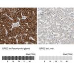 GPD2 Antibody in Immunohistochemistry (IHC)