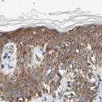 GPD2 Antibody in Immunohistochemistry (IHC)