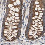 GPD2 Antibody in Immunohistochemistry (IHC)