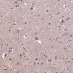 SLC6A17 Antibody in Immunohistochemistry (IHC)