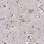 SLC6A17 Antibody in Immunohistochemistry (IHC)