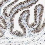 RNF43 Antibody in Immunohistochemistry (IHC)