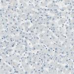 RNF43 Antibody in Immunohistochemistry (IHC)