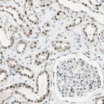 RNF43 Antibody in Immunohistochemistry (IHC)