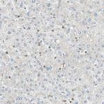 FMNL1 Antibody in Immunohistochemistry (IHC)