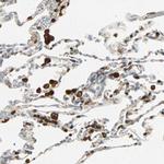 FMNL1 Antibody in Immunohistochemistry (IHC)