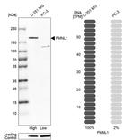 FMNL1 Antibody in Western Blot (WB)