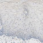 ATP6V1B2 Antibody in Immunohistochemistry (Paraffin) (IHC (P))