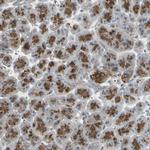 ATP6V1B2 Antibody in Immunohistochemistry (Paraffin) (IHC (P))