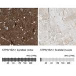 ATP6V1B2 Antibody in Immunohistochemistry (IHC)