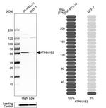 ATP6V1B2 Antibody in Western Blot (WB)