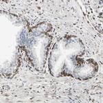 LAP2 Antibody in Immunohistochemistry (Paraffin) (IHC (P))