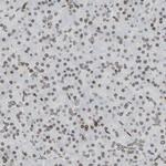 LAP2 Antibody in Immunohistochemistry (IHC)