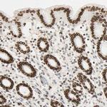 LAP2 Antibody in Immunohistochemistry (IHC)