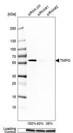 LAP2 Antibody in Western Blot (WB)