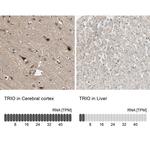 TRIO Antibody in Immunohistochemistry (IHC)