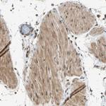 TRIO Antibody in Immunohistochemistry (IHC)