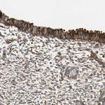 TRIO Antibody in Immunohistochemistry (IHC)