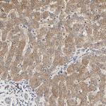 TSKU Antibody in Immunohistochemistry (IHC)