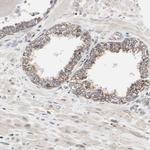 TSKU Antibody in Immunohistochemistry (IHC)