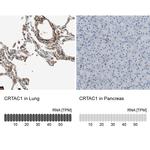 CRTAC1 Antibody in Immunohistochemistry (IHC)