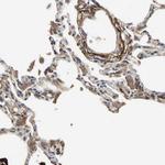 CRTAC1 Antibody in Immunohistochemistry (IHC)