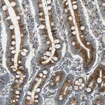 Nucleobindin 1 Antibody in Immunohistochemistry (IHC)