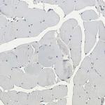 NAPG Antibody in Immunohistochemistry (IHC)