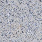 PLGRKT Antibody in Immunohistochemistry (Paraffin) (IHC (P))