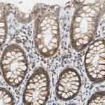 PLGRKT Antibody in Immunohistochemistry (Paraffin) (IHC (P))