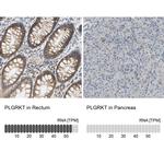 PLGRKT Antibody in Immunohistochemistry (IHC)