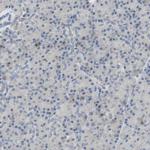 PLGRKT Antibody in Immunohistochemistry (IHC)