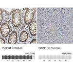 PLGRKT Antibody