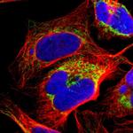 ME2 Antibody in Immunocytochemistry (ICC/IF)