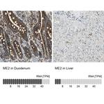 ME2 Antibody in Immunohistochemistry (IHC)