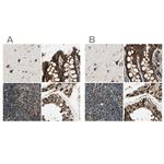 ME2 Antibody in Immunohistochemistry (IHC)