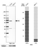 ME2 Antibody in Western Blot (WB)